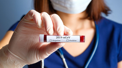 Nurse holding test tube with blood for 2019-nCoV analyzing. Novel Chinese Coronavirus blood test...