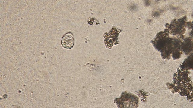 Microscopy of protozoa ciliate and small microorganisms in the water sample. Magnification 300x infusoria under microscope in active movement and feed process.