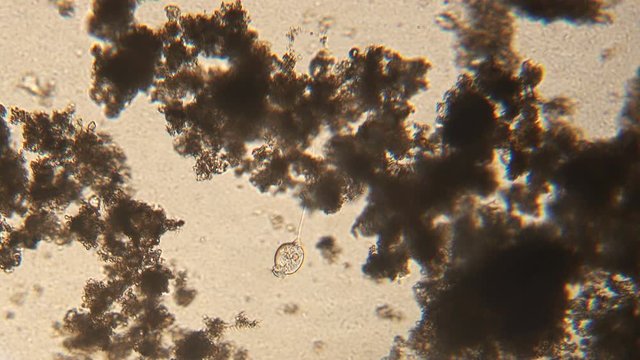 Microscopy of protozoa Vorticella in the water (pond) sample. Infusoria attached to the substrate and draws water with bacteria. Magnification 150x movement of cilia on the front of body.
