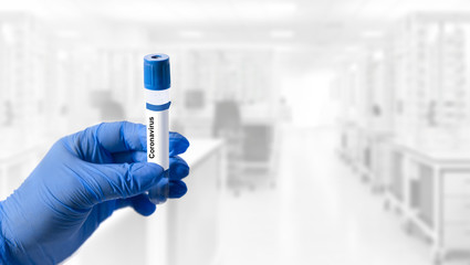 Nurse holding blood test tube with result Coronavirus Test. 2019-nCoV virus originating in Wuhan, China Diagnostic Labs