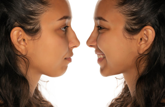 comparison portrait of young latin woman before and after nose job
