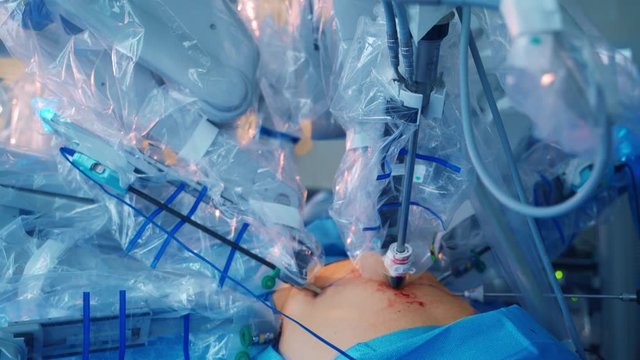 Da Vinci Surgery. Medical operation involving robot. Future of Medicine