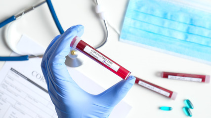 Coronavirus blood test concept. Doctor hand in medical glove holding test tube with Coronavirus positive blood in laboratory. 2019-nCoV Coronavirus originating in Wuhan, China