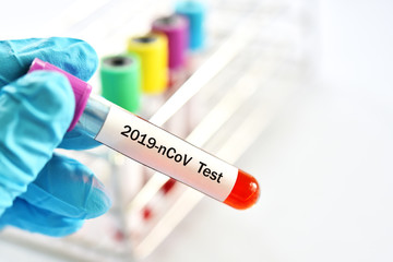 Fototapeta premium Test tube with blood sample for coronavirus 2019 (2019-nCoV) test