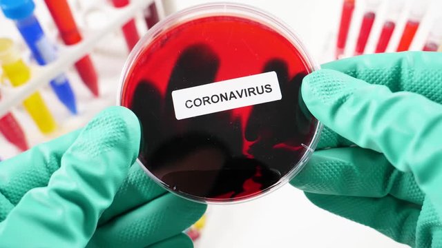 Laboratory scientist showing an agar plate containing the Coronavirus. Closeup shot of the object in focus. Wearing a biohazard hazmat suit.