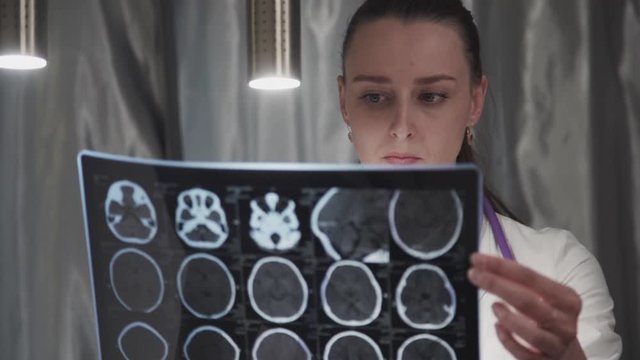 Woman doctor is watching x-ray of brain while sitting at table in clinic. Young female expert holding MRI shot in hand, working at desk in modern hospital. Professional wearing white coat. Concept