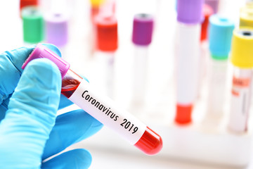 Test tube with blood sample for coronavirus 2019 (2019-nCoV) test