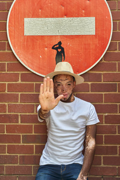 Portrait of young man with vitiligo wearing a hat doing a stop sign with his hand on a forbidden sign