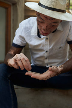 Young man with vitiligo rolling a cigarette