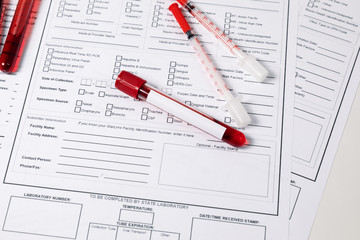 Test tubes with blood. nCov, Coronavirus test