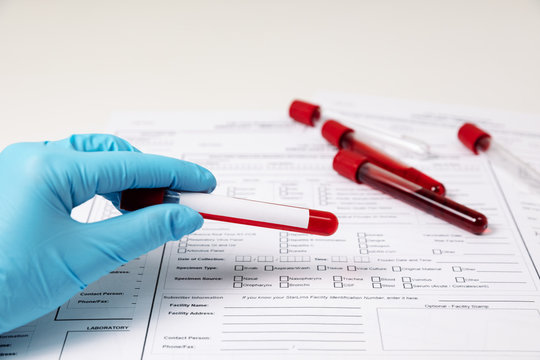 Test tubes with blood. nCov, Coronavirus test