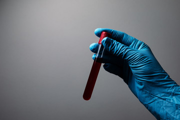 Doctor's hand with blood probe. Coronavirus test