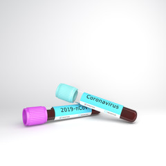 Coronavirus 2019-nCoV blood test tube on studio lighting white background, 3D rendering illustration.