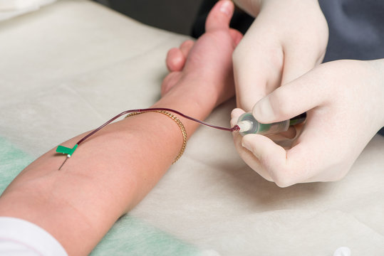 Hands in latex medical gloves make vein puncture in area of ulnar bend of patient 's hand