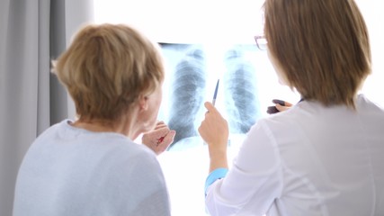 Doctor Explaining X-Ray Results To Senior Patient