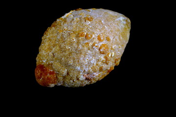 Gallenstein
