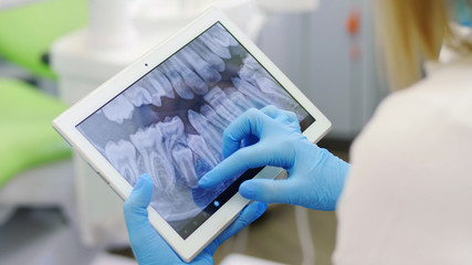 Dentist shows on the tablet x-ray teeth, close-up. Modern dentistry. X-ray of the teeth on a portable device © DiedovStock