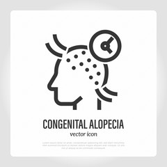 Congenital alopecia thin line icon. Hair loss. Bald place on scalp. Vector illustration.