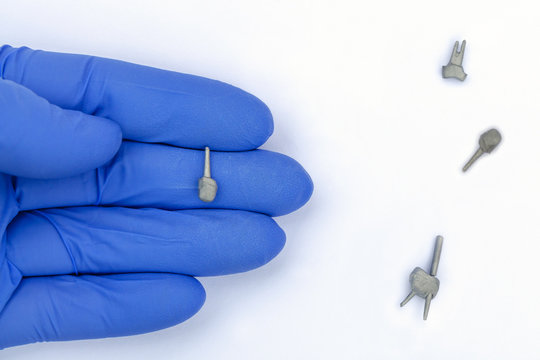the dentist holds a cast tooth pin in his hand. several molded pins lie nearby. concept of tooth restoration using pins on the roots of the teeth