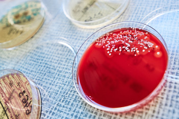 Petri dishes with bacterial colonies