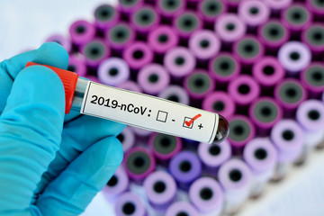 Obraz premium Blood sample tube positive with 2019-nCoV, novel coronavirus 2019 found in Wuhan, China