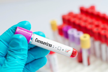 Blood sample tube positive with 2019-nCoV, novel coronavirus 2019 found in Wuhan, China