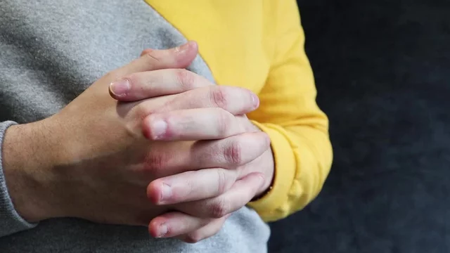 Ugly ugryzienie fingers, biting nails, cuticles, wounds on the fingers.  Nail-biting habit. The concept of onychophagy. unattended nail, cracked  skin, bad nail grooming.