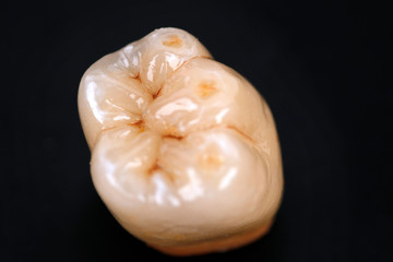 dental ceramic crowns, natural color effects