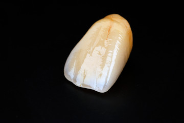 dental ceramic crowns, natural color effects