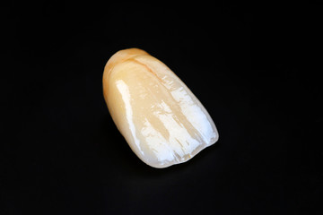 dental ceramic crowns, natural color effects