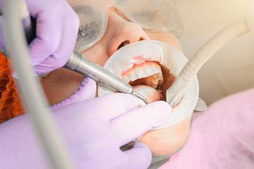 Dentist ultrasound removes stones on the teeth of a woman with a dental pad on her mouth.