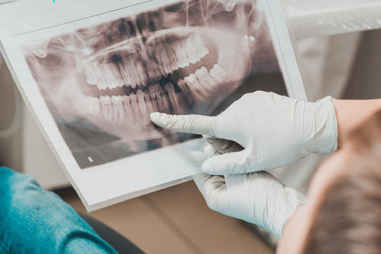 An orthodontist doctor shows the boy an x-ray of his teeth. - Powered by Adobe