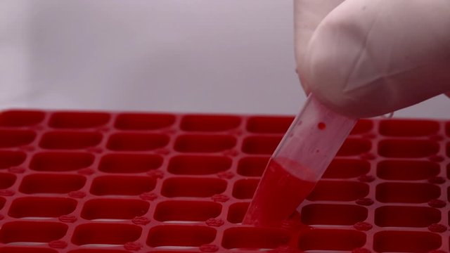 Health worker showing vial with coronavirus blood sample