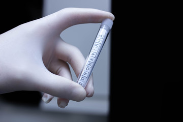 laboratory test tube coronavirus diagnosis concept