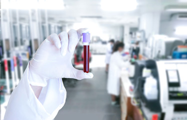 Medical scientists do a blood virus test check tube in the lab