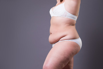 Tummy tuck, flabby skin on a fat belly, plastic surgery concept