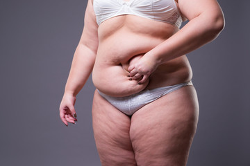 Tummy tuck, flabby skin on a fat belly, plastic surgery concept