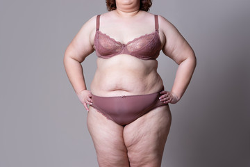 Tummy tuck, flabby skin on a fat belly, plastic surgery concept