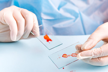 lab technician dripping human red blood on slide glass for virus test on blue background