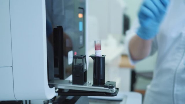 professional medicine research. test tubes blood glasses are getting inserted into a biochemical analyzer by a lab worker medical scientist
