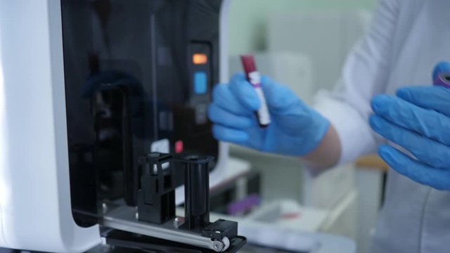 scientist working with blood samples probes at modern lab equipment technology