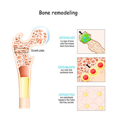 bone remodeling process. Osteoblast, osteoclast, and osteocyte.