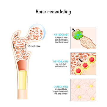 bone remodeling process. Osteoblast, osteoclast, and osteocyte.