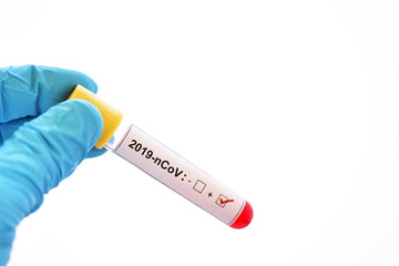 Obraz premium Blood sample tube positive with coronavirus 2019 or 2019-nCoV, novel coronavirus found in Wuhan, China