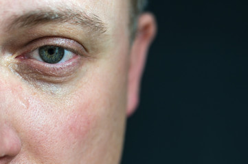 Trauriger und schmerzerfüllter Blick eines jungen Mannes vor schwarzem Hintergrund