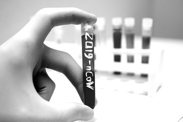 epidemic test and analysis coronavirus 2019-nCoV, a vaccine and a cure for the virus appeared in Wuhan, China