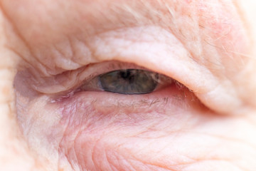 Close-up. Woman aged. Eye in the center of the frame. The pupil has soft focus, the concept of poor eyesight, everything is blurry