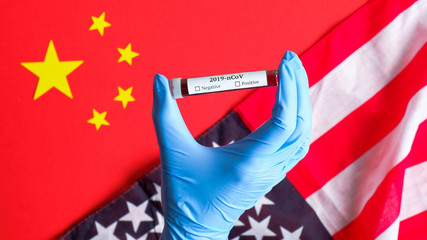 Novel coronavirus outbreak in USA concept. Nurse hand holding blood test tube with label 2019-nCoV over Chinese flag and flag of the United States of America. Pandemic virus disease, pneumonia