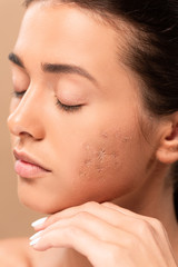 Naklejka premium young woman with closed eyes and acne on face isolated on beige