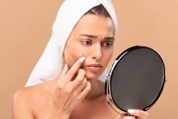 upset nude girl in towel touching acne on face and looking at mirror isolated on beige